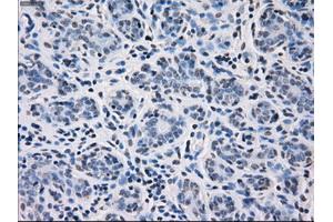 Immunohistochemistry (IHC) image for anti-Fc Fragment of IgG, Low Affinity IIa, Receptor (CD32) (FCGR2A) antibody (ABIN1497262) (FCGR2A 抗体)