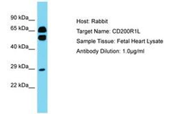 CD200R1L 抗体  (AA 87-136)