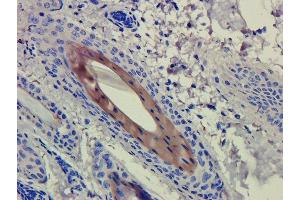 Immunohistochemistry (IHC) image for anti-CD4 (Clenoliximab Biosimilar) antibody (ABIN5668247)