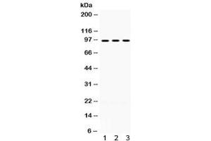 Western blot testing of human 1) A549, 2) SKOV and 3) SW620 lysate with OPA1 antibody. (OPA1 抗体)