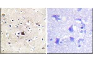 Immunohistochemistry analysis of paraffin-embedded human brain tissue, using GR (Ab-226) Antibody. (GR (AA 201-250) 抗体)