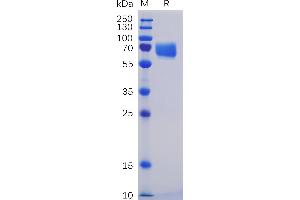 Human SL Protein, mFc-His Tag on SDS-PAGE under reducing condition. (CD84 Protein (CD84) (AA 22-225) (mFc-His Tag))