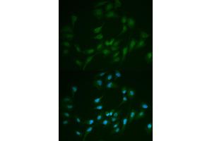 Immunofluorescence analysis of MCF-7 cells using LIG1 antibody. (LIG1 抗体)