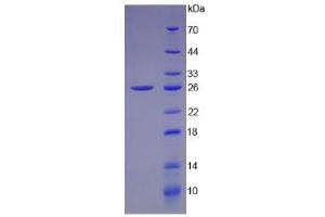 SDS-PAGE analysis of Human Connexin 43 Protein. (Connexin 43/GJA1 蛋白)