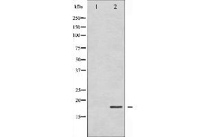 Western blot analysis of Cofilin expression in COLO205 whole cell lysates,The lane on the left is treated with the antigen-specific peptide. (Cofilin 抗体  (N-Term))