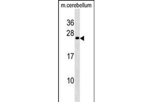 Mouse BAD Antibody (Center //) (ABIN6243058 and ABIN6577363) western blot analysis in mouse cerebellum tissue lysates (35 μg/lane). (BAD 抗体  (AA 90-118))