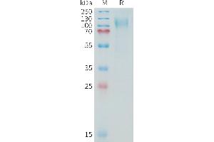 MUC16 Protein (AA 13810-14451) (His tag)