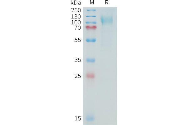 MUC16 Protein (AA 13810-14451) (His tag)