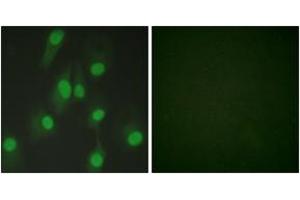 Immunofluorescence analysis of HeLa cells, using Chk1 (Ab-286) Antibody. (CHEK1 抗体  (AA 256-305))