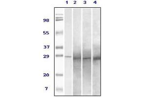 Western blot analysis using Rab25 antibody against truncated Rab25 recombinant protein (1), human overy carcinoma (2), stomach carcinoma (3), breast carcinoma (4) tissue lysate. (RAB25 抗体)