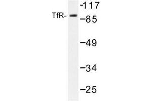 Image no. 2 for anti-Transferrin Receptor (p90, CD71) (TFRC) antibody (ABIN272097) (Transferrin Receptor 抗体)