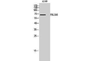 Western Blotting (WB) image for anti-PDZ and LIM Domain 5 (PDLIM5) (Tyr564) antibody (ABIN3176819) (PDLIM5 抗体  (Tyr564))