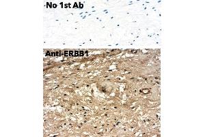 Immunohistochemistry (IHC) image for anti-Epidermal Growth Factor Receptor (EGFR) (C-Term) antibody (ABIN6254171) (EGFR 抗体  (C-Term))