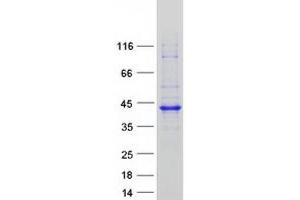 RP2 Protein (Myc-DYKDDDDK Tag)