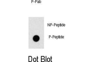 Image no. 1 for anti-Zinc Finger and BTB Domain Containing 16 (ZBTB16) (pTyr334) antibody (ABIN358501) (ZBTB16 抗体  (pTyr334))