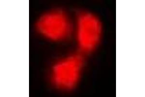 Immunofluorescent analysis of Beta 2 Microglobulin staining in Hela cells. (beta-2 Microglobulin 抗体)