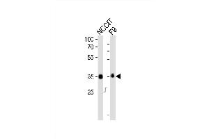 Western blot analysis of lysates from NCCIT, mouse F9 cell line (from left to right), using Sox2 Antibody (N-term) (ABIN6243281 and ABIN6577707). (SOX2 抗体  (N-Term))