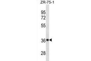 Western Blotting (WB) image for anti-Cysteine and Histidine-Rich Domain (CHORD)-Containing 1 (CHORDC1) antibody (ABIN3001211) (CHORDC1 抗体)