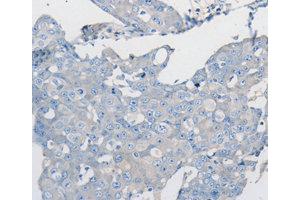 Immunohistochemistry (IHC) image for anti-Protein Phosphatase 2, Catalytic Subunit, beta Isozyme (PPP2CB) antibody (ABIN1874224) (PPP2CB 抗体)