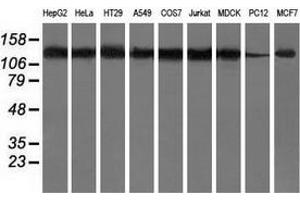 Western blot analysis of extracts (35 µg) from 9 different cell lines by using anti-HDAC6 monoclonal antibody. (HDAC6 抗体)