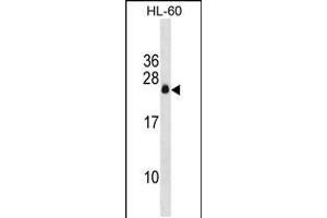 Western blot analysis in HL-60 cell line lysates (35ug/lane). (C3ORF35 抗体  (AA 59-88))