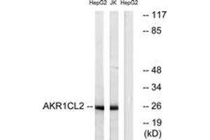 Western blot analysis of extracts from HepG2/Jurkat cells, using AKR1CL2 Antibody. (AKR1E2 抗体  (AA 141-190))