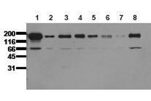 Western Blotting (WB) image for anti-Epidermal Growth Factor Receptor (EGFR) (C-Term) antibody (ABIN126786) (EGFR 抗体  (C-Term))