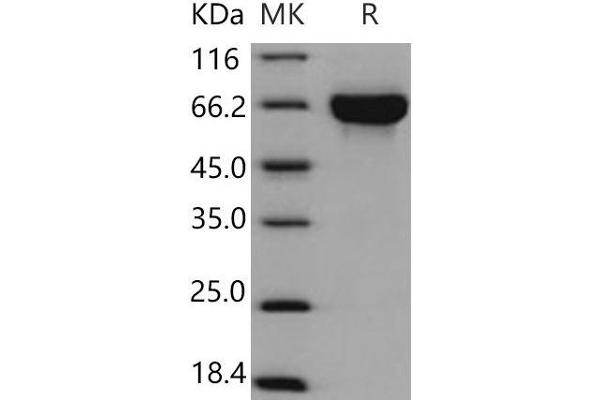 KIRREL3 Protein (His tag)