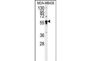 Western blot analysis in MDA-MB435 cell line lysates (35ug/lane). (ARHGEF3 抗体  (AA 211-240))