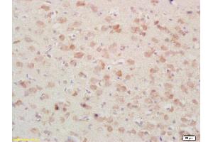 Formalin-fixed and paraffin embedded rat brain tissue labeled Anti-PSAP/PAP Polyclonal Antibody, Unconjugated (ABIN735773) at 1:200, followed by conjugation to the secondary antibody and DAB staining (Prosaposin 抗体  (AA 101-200))