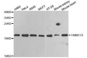 Western blot analysis of extracts of various cell lines, using TIMM17A antibody. (TIMM17A 抗体  (AA 1-171))