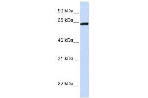 LCP1 antibody used at 1 ug/ml to detect target protein. (LCP1 抗体)