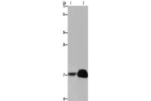 Western Blotting (WB) image for anti-Fragile Histidine Triad (FHIT) antibody (ABIN2423468) (FHIT 抗体)