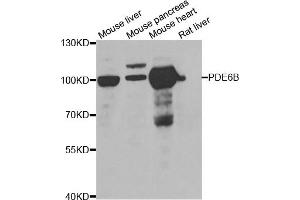 Western blot analysis of extracts of various cell lines, using PDE6B antibody (ABIN5975450) at 1/1000 dilution. (PDE6B 抗体)