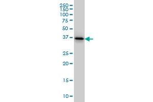 Western Blotting (WB) image for anti-Twinfilin, Actin-Binding Protein 1 (TWF1) (AA 80-252) antibody (ABIN562523)