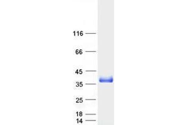 TMX1 Protein (Myc-DYKDDDDK Tag)