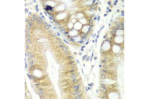 Immunohistochemistry of paraffin-embedded human colon using CES2 antibody (ABIN5970708) at dilution of 1/100 (40x lens). (CES2 抗体)