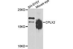 Western blot analysis of extracts of SH-SY5Y and mouse eye cell lines, using CPLX2 antibody. (CPLX2 抗体)