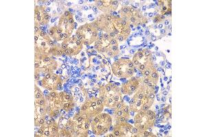Immunohistochemistry of paraffin-embedded rat kidney using HPD antibody at dilution of 1:100 (x40 lens). (HPD 抗体)