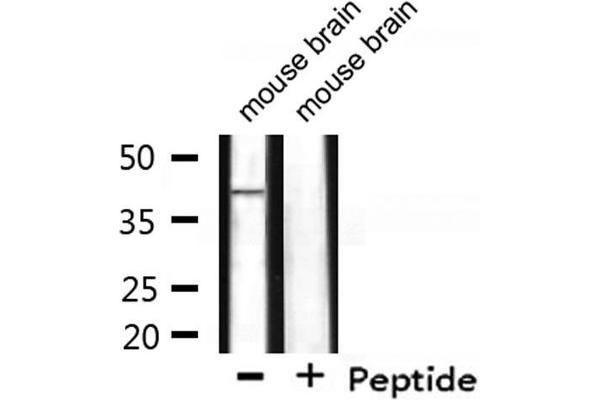 WNT7A 抗体  (Internal Region)