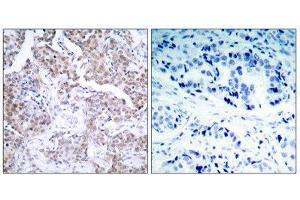 Immunohistochemistry (IHC) image for anti-Tumor Protein P53 (TP53) (pSer15) antibody (ABIN1847519) (p53 抗体  (pSer15))