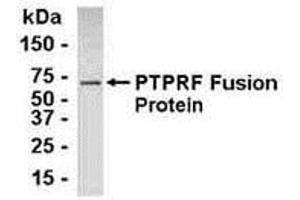 Western Blotting (WB) image for anti-Protein Tyrosine Phosphatase Receptor Type F (PTPRF) (AA 1151-1225) antibody (ABIN2467995) (PTPRF 抗体  (AA 1151-1225))