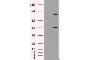 HEK293T cells were transfected with the pCMV6-ENTRY control (Left lane) or pCMV6-ENTRY PSMC3 (Right lane) cDNA for 48 hrs and lysed. (PSMC3 抗体)