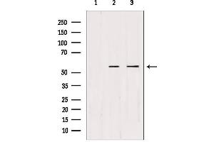 CDKL2 抗体  (Internal Region)