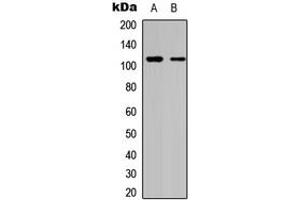 Western blot analysis of DAXX expression in HeLa (A), A549 (B) whole cell lysates. (DAXX 抗体  (C-Term))