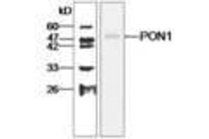 Image no. 1 for anti-Paraoxonase 1 (PON1) antibody (ABIN791456) (PON1 抗体)