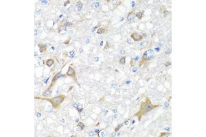 Immunohistochemistry of paraffin-embedded rat brain using IL22 antibody (ABIN5975407) at dilution of 1/100 (40x lens). (IL-22 抗体)