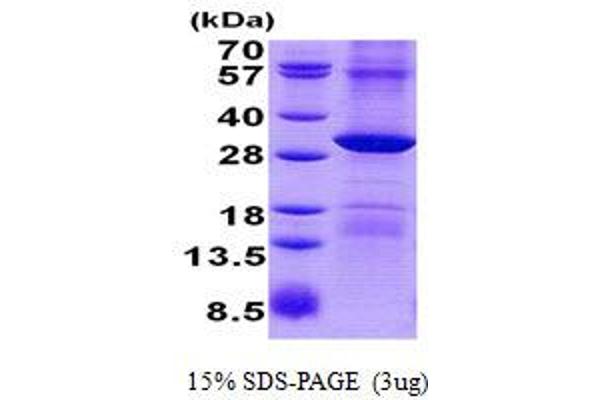 RPP29 Protein (His tag)