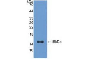 Detection of Recombinant ACO1, Human using Polyclonal Antibody to Aconitase 1 (ACO1) (Aconitase 1 抗体  (AA 458-586))