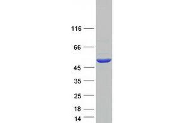 DLST Protein (Myc-DYKDDDDK Tag)